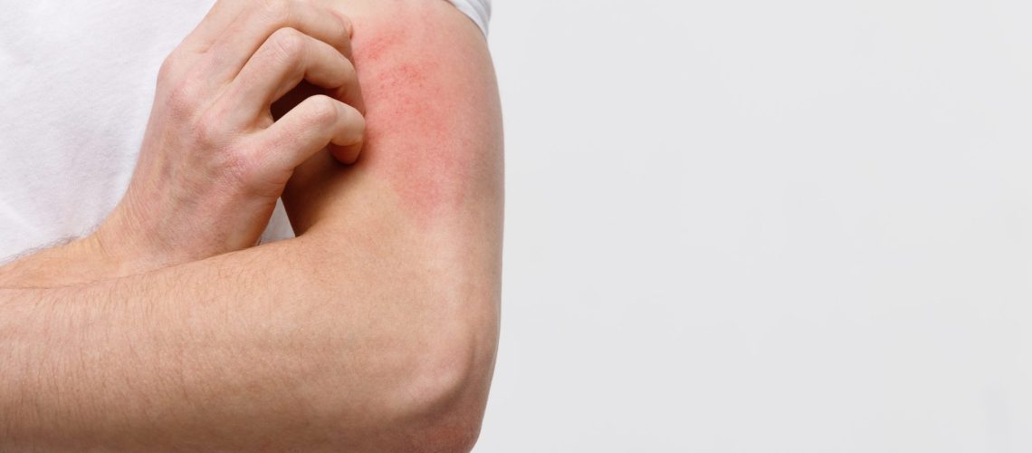 close-up-male-scratching-itch-his-hand-isolated-grey-background