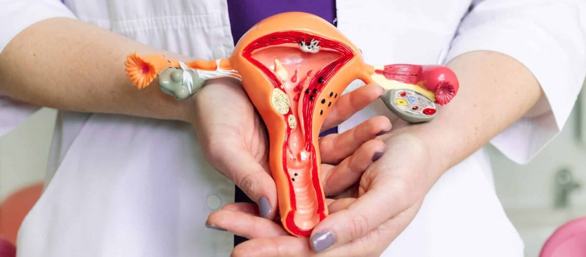 Female gynecologist doctor hands hold a layout of the female reproductive system.